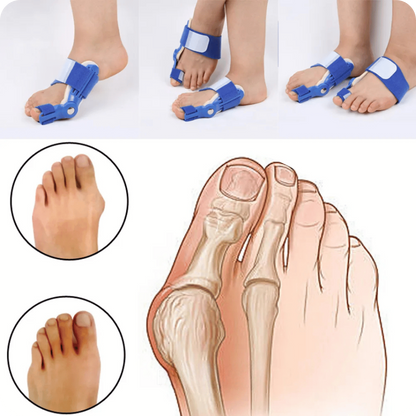 FlexiToe: Corrector de Juanetes - [PROMOCIÓN DISPONIBLE SOLO HOY]